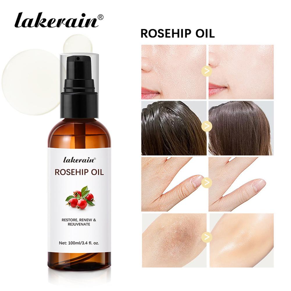 Rosehip Oil For Face & Skin Or – Cold Pressed Rose Hip Bewertung und Preis