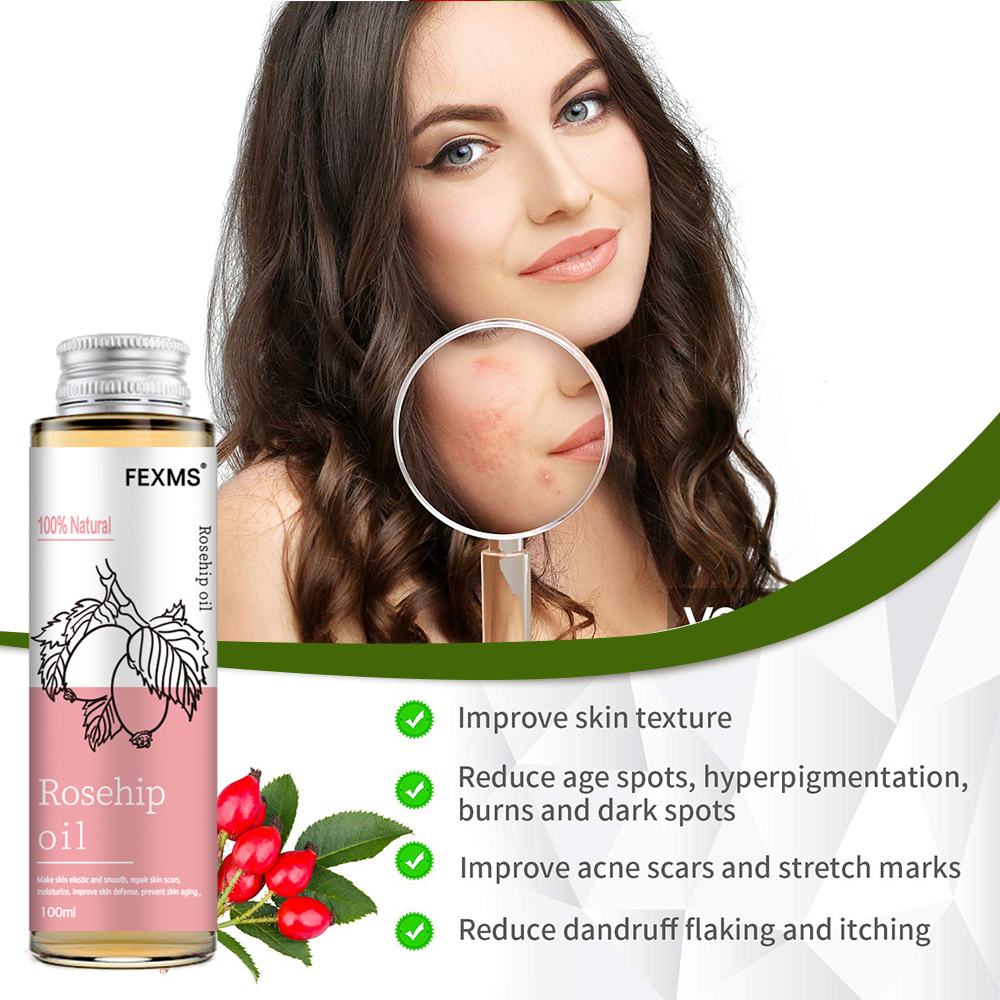 Rosehip Seed Oil, 100% Pure Or – Cold Pressed Rose Hip Bewertung und Preis