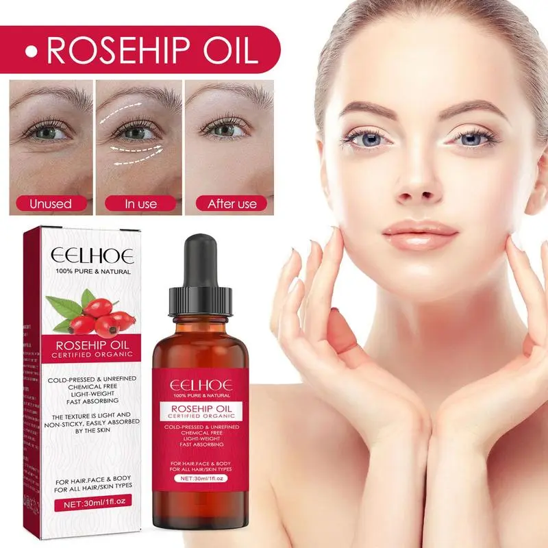 30ml Organic Rosehip Seed Oil  – Cold Pressed Rose Hip Bewertung und Preis