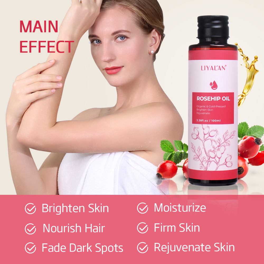 100ml Rosehip Oil Brighten Fir – Cold Pressed Rose Hip Bewertung und Preis